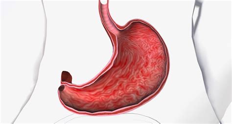 estomac inflamat